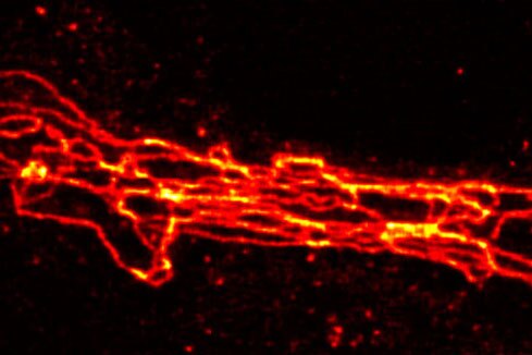 Proteinstrukturen in einer Zelle unter dem STED-Mikroskop leuchten rot