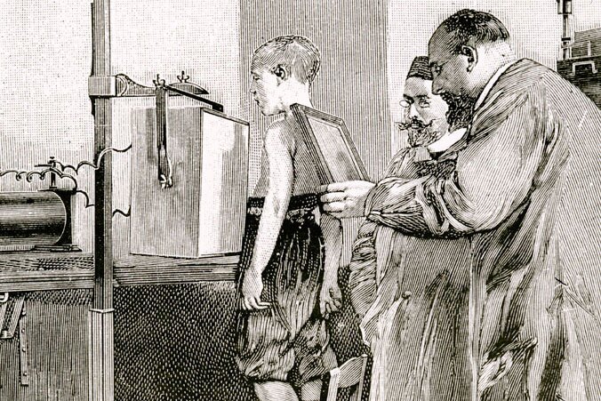 Zeichnung einer Untersuchung eines Jungen mit Röntgenstrahlen, um 1900